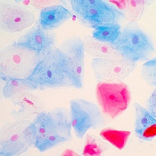 Bild Zytologie – klein