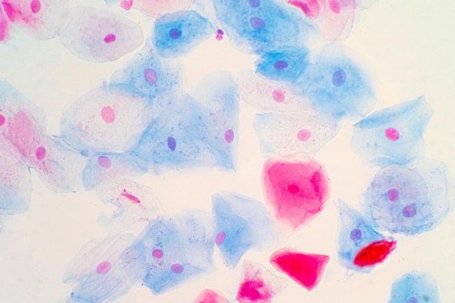 Bild Zytologie – klein